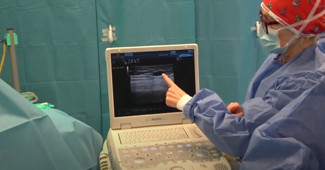 Chirurgia vascolare con laser al Coq di Omegna. Abbiamo seguito due interventi, guarda la puntata di In Salute