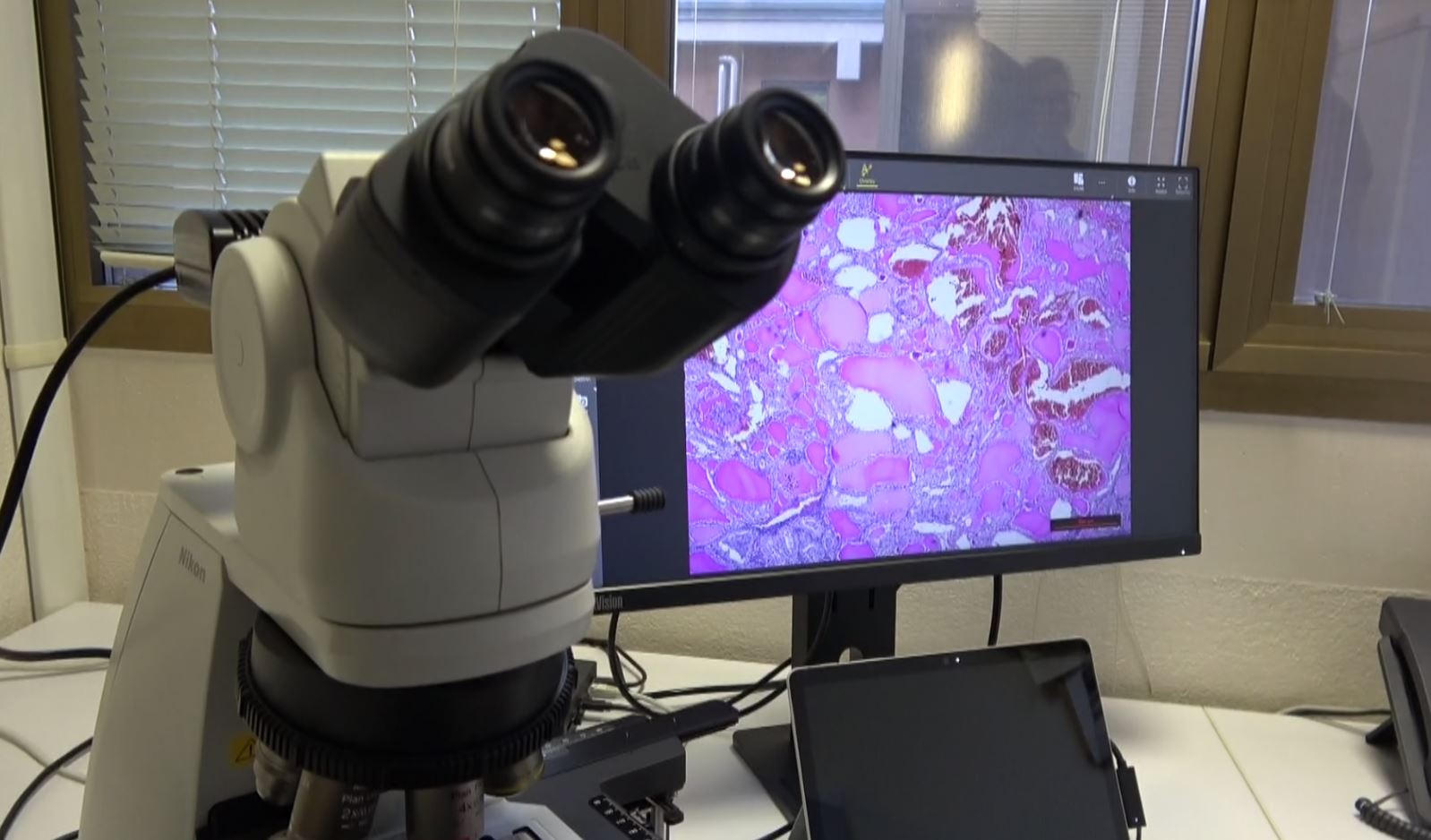 Nuova donazione degli Amici dell’Oncologia: un microscopio di ultima generazione per l’anatomia patologica dell’Asl Vco